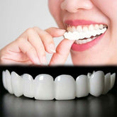 Generic Smile Temporal muestra sonrisa natural para fotos y eventos.