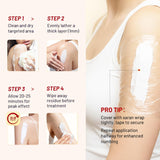 Acolye Uso localizado para dolor o irritación.