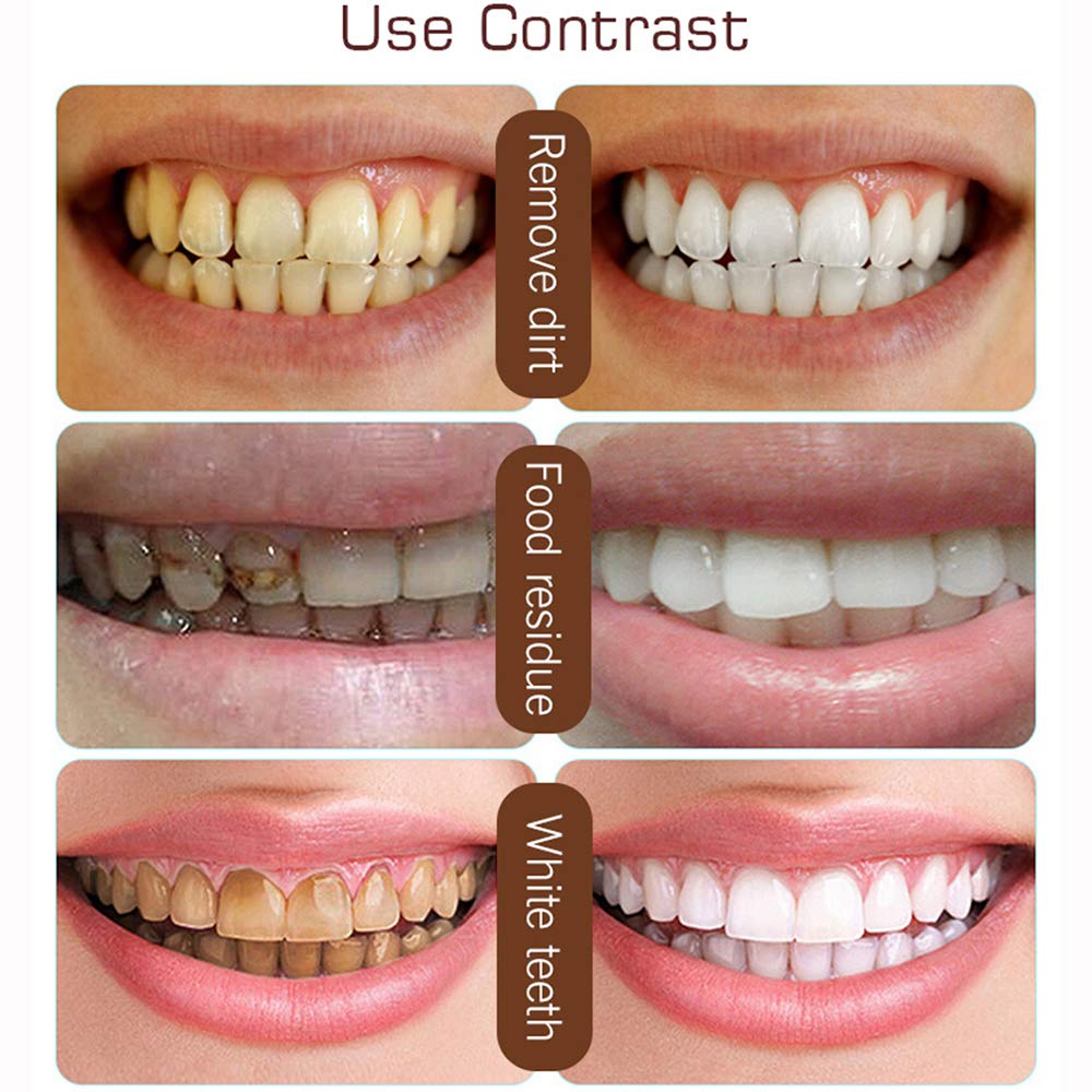 Resultados visibles en brillo dental con cepillado regular