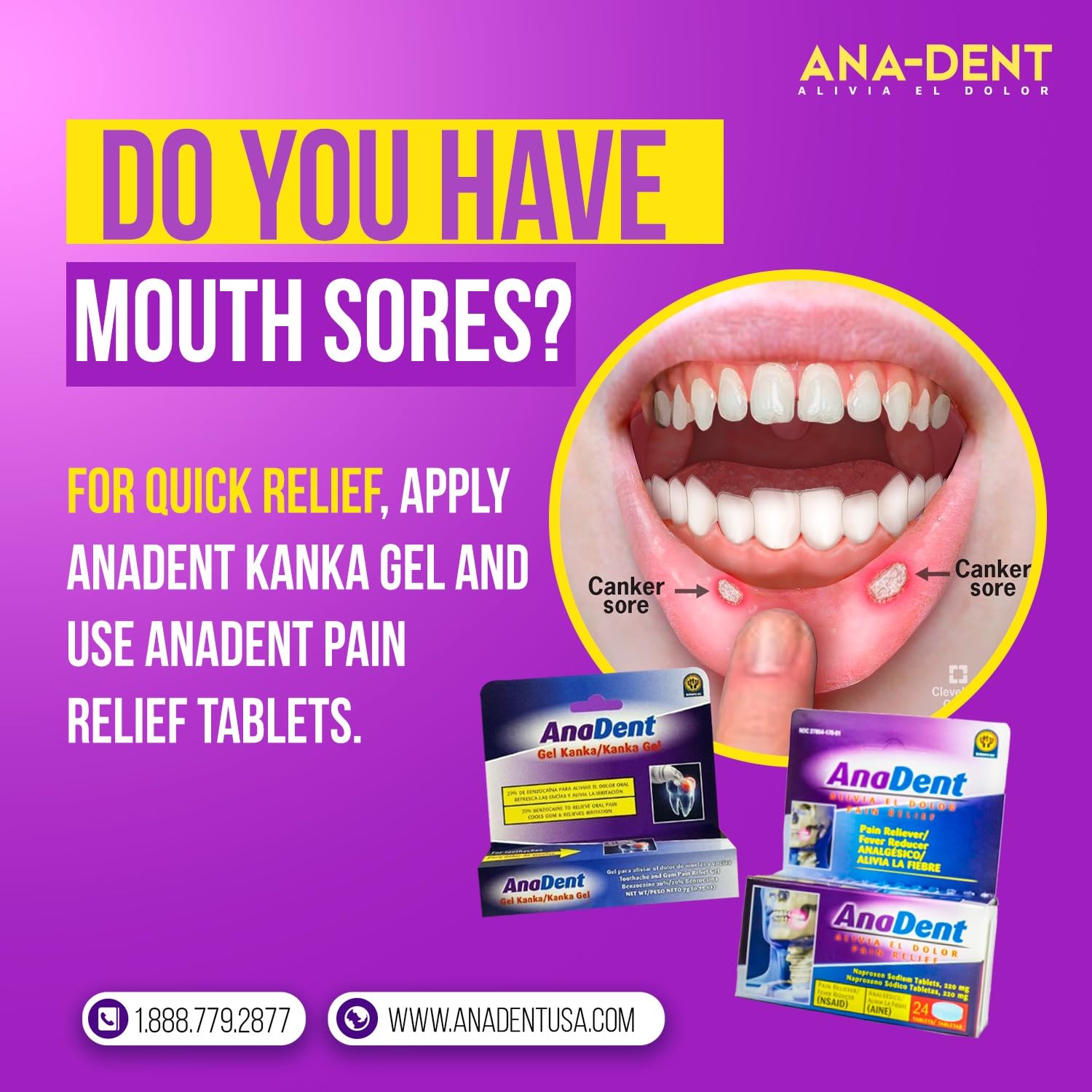 Textura gel dental de Anadent, fácil de aplicar