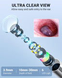 Anykit herramientas de cerumen con protección suave para uso seguro