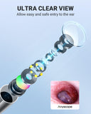 AnyScope aplicación dedicada de endoscopio para visualización en dispositivos.