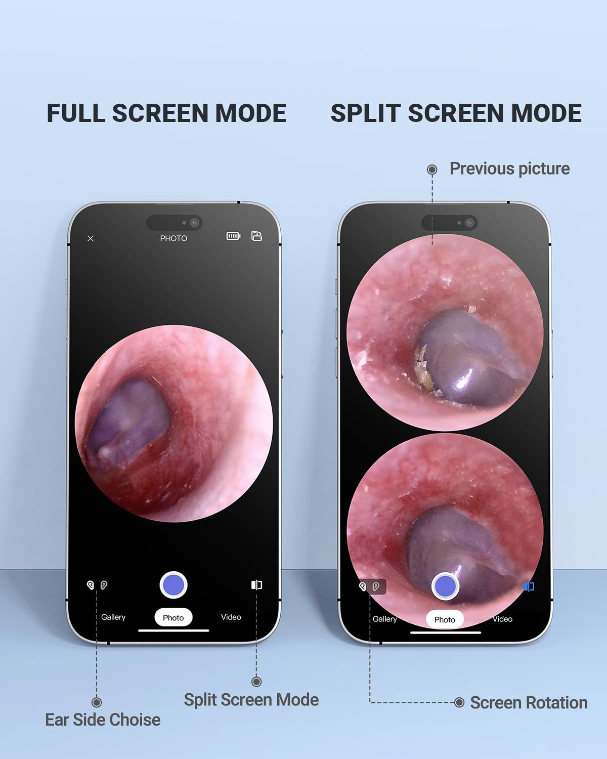 AnyScope conexión Wi-Fi del otoscopio para usar sin Bluetooth.