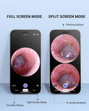 AnyScope conexión Wi-Fi del otoscopio para usar sin Bluetooth.