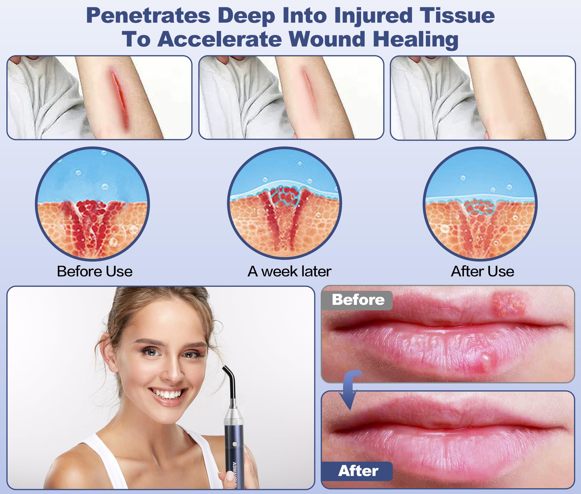 Aswaysun terapia para rostro y nariz con luz infrarroja, uso suave en piel.