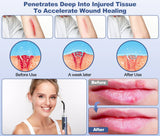 Aswaysun terapia para rostro y nariz con luz infrarroja, uso suave en piel.