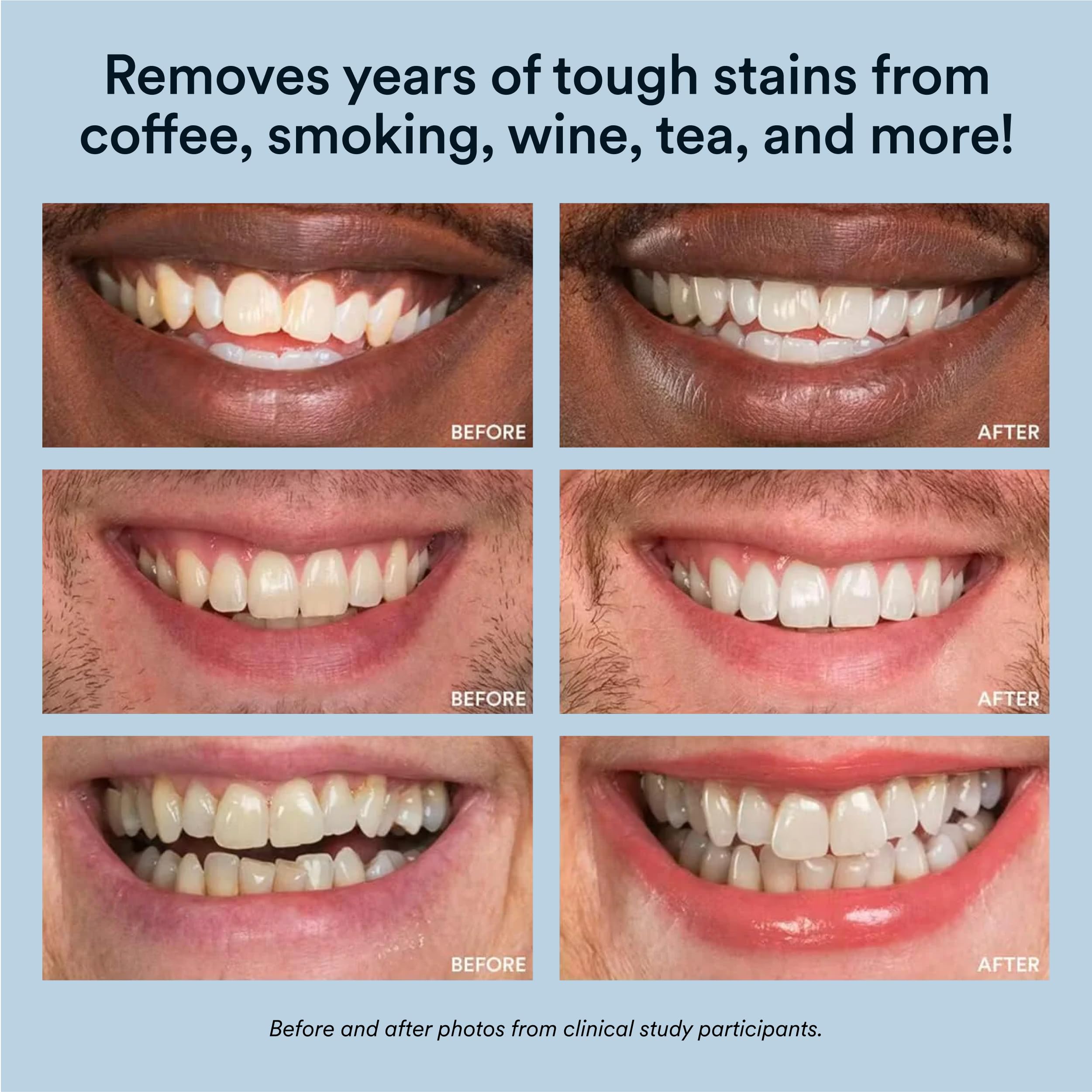 Auraglow: empaque del kit y accesorios listos para empezar.