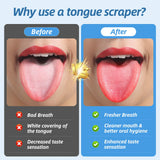 Aussumy escariador lengua forma u para limpieza diaria eficaz