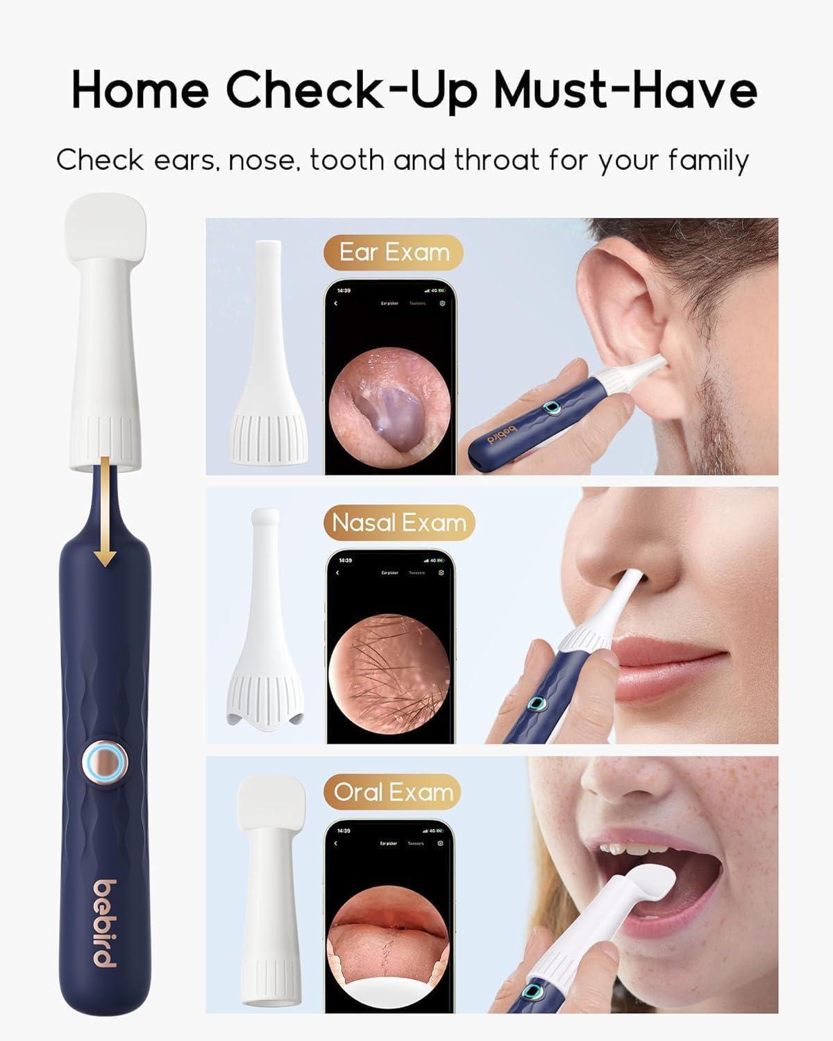 BEBIRD Earsight Plus: inspección iluminada para chequeos en casa.