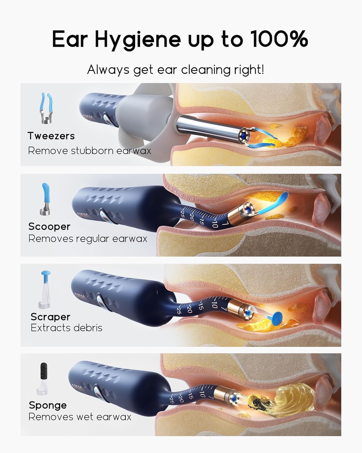 BEBIRD Earsight Plus: pinzas suaves para limpieza más delicada.