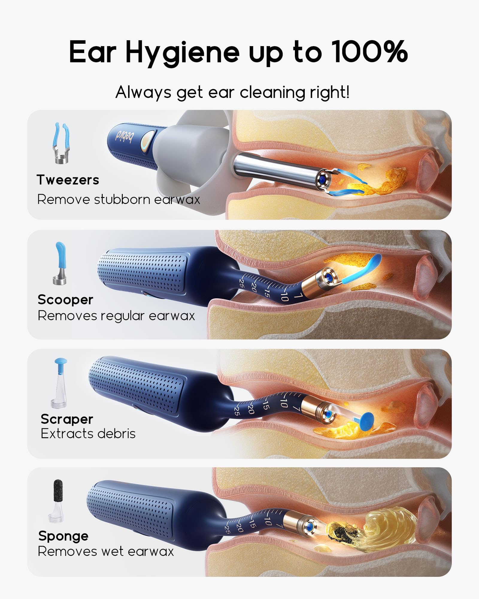 BEBIRD Earsight Plus R37R: herramientas de seguridad para evitar sobreinserción