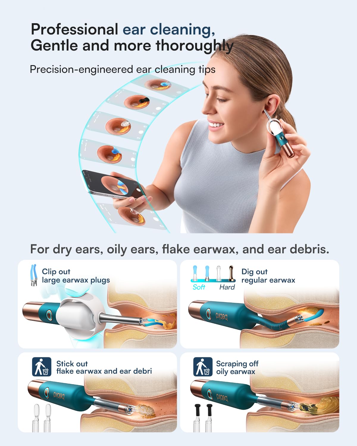 BEBIRD Earsight Ultra endoscopio para uso doméstico y revisión