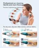 BEBIRD Earsight Ultra endoscopio para uso doméstico y revisión