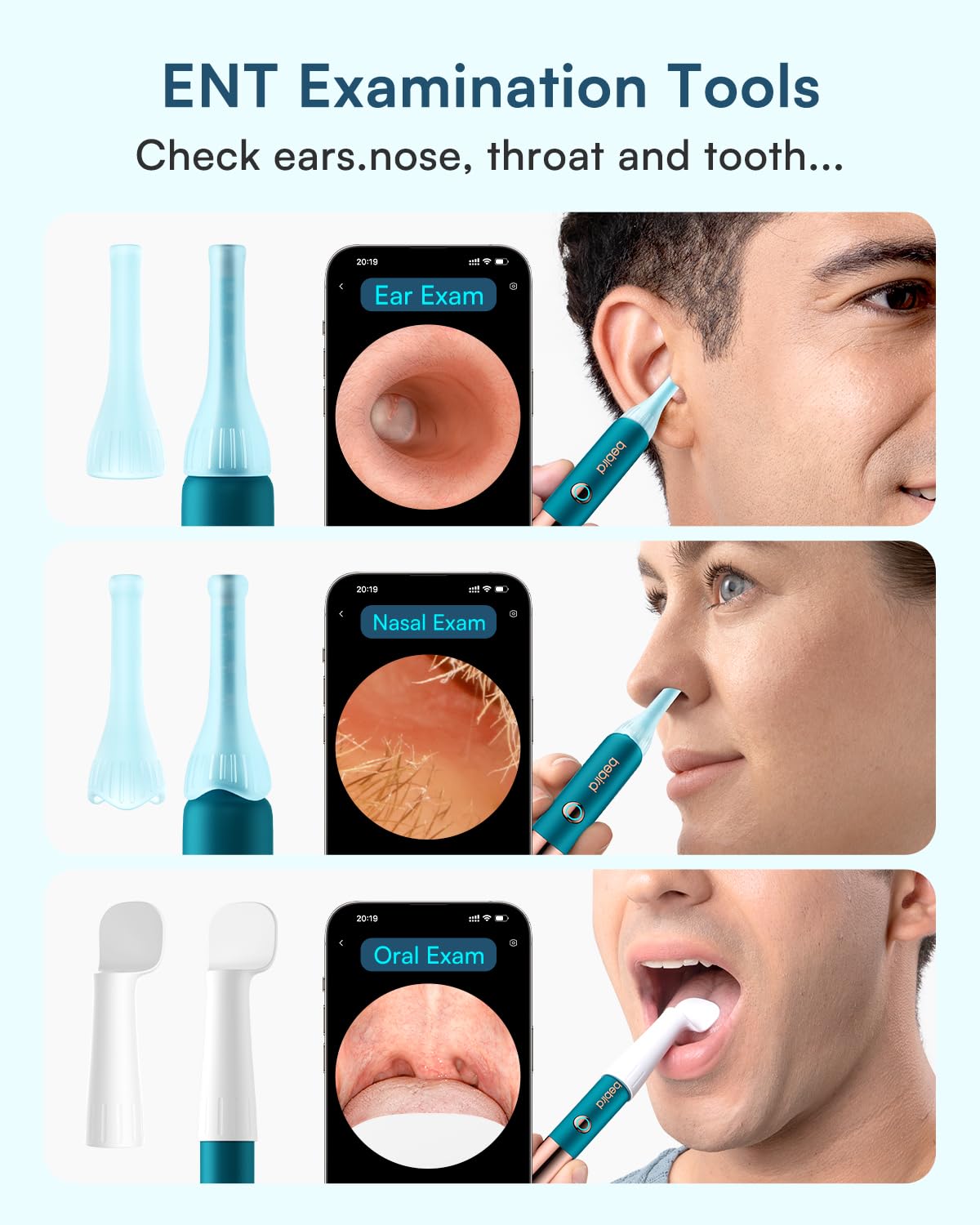 BEBIRD Earsight Ultra con garantía de 24 meses.