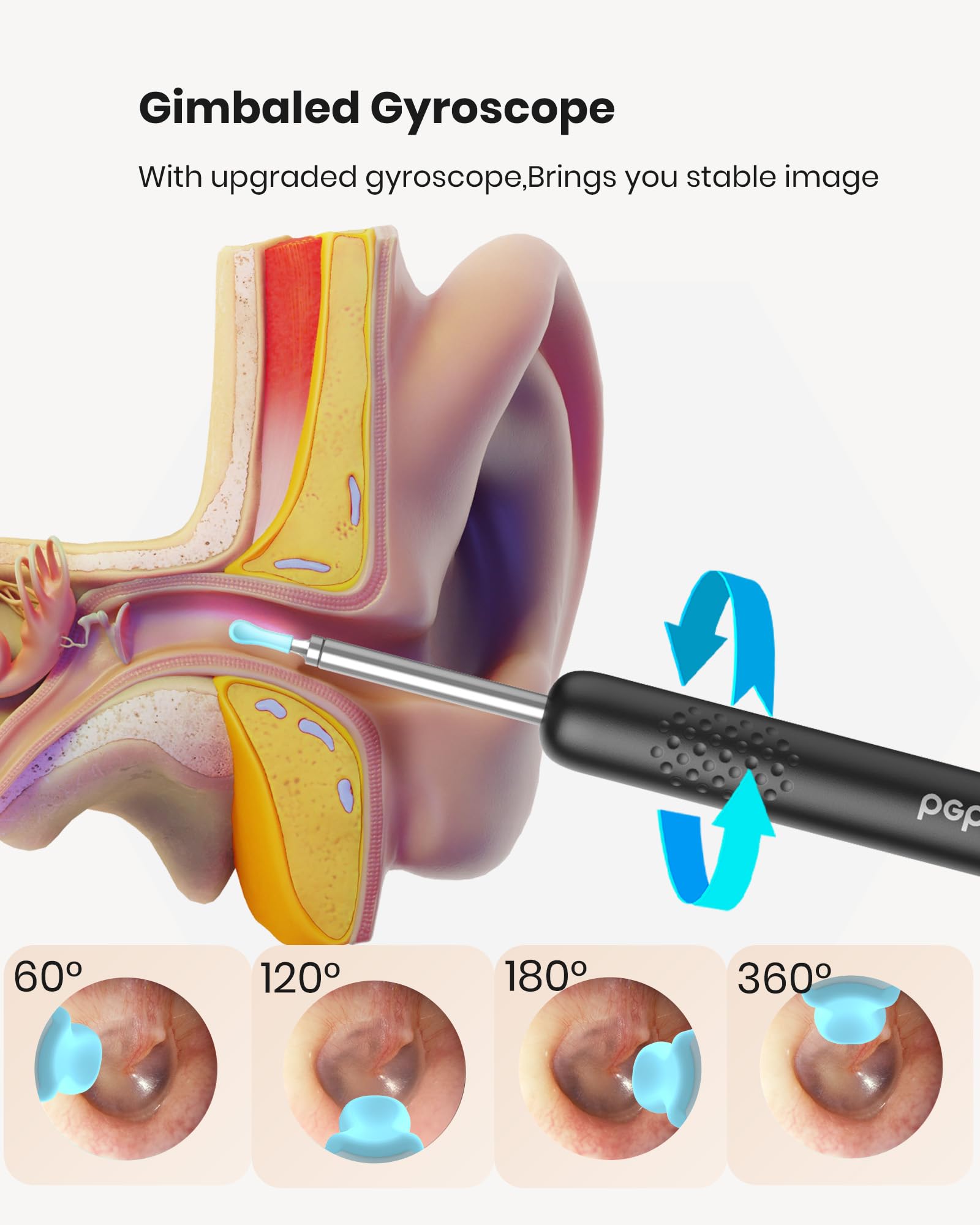 BEBIRD R1: observación de la cavidad nasal para revisión