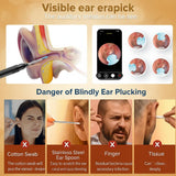 Bekhic accesorios de 8 piezas para diferentes formas de oreja.