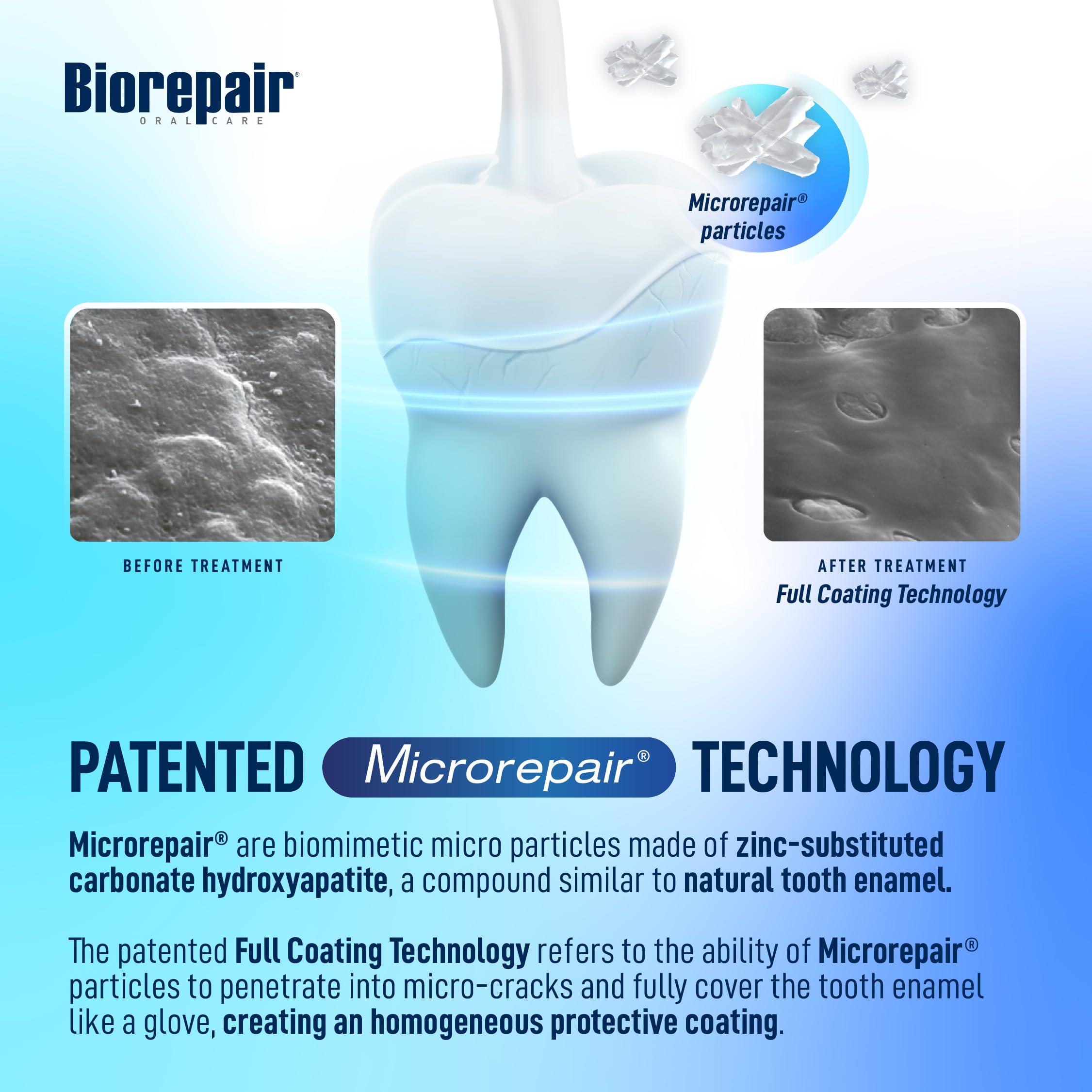 Biorepair remineralización de esmalte, enfoque con microRepair