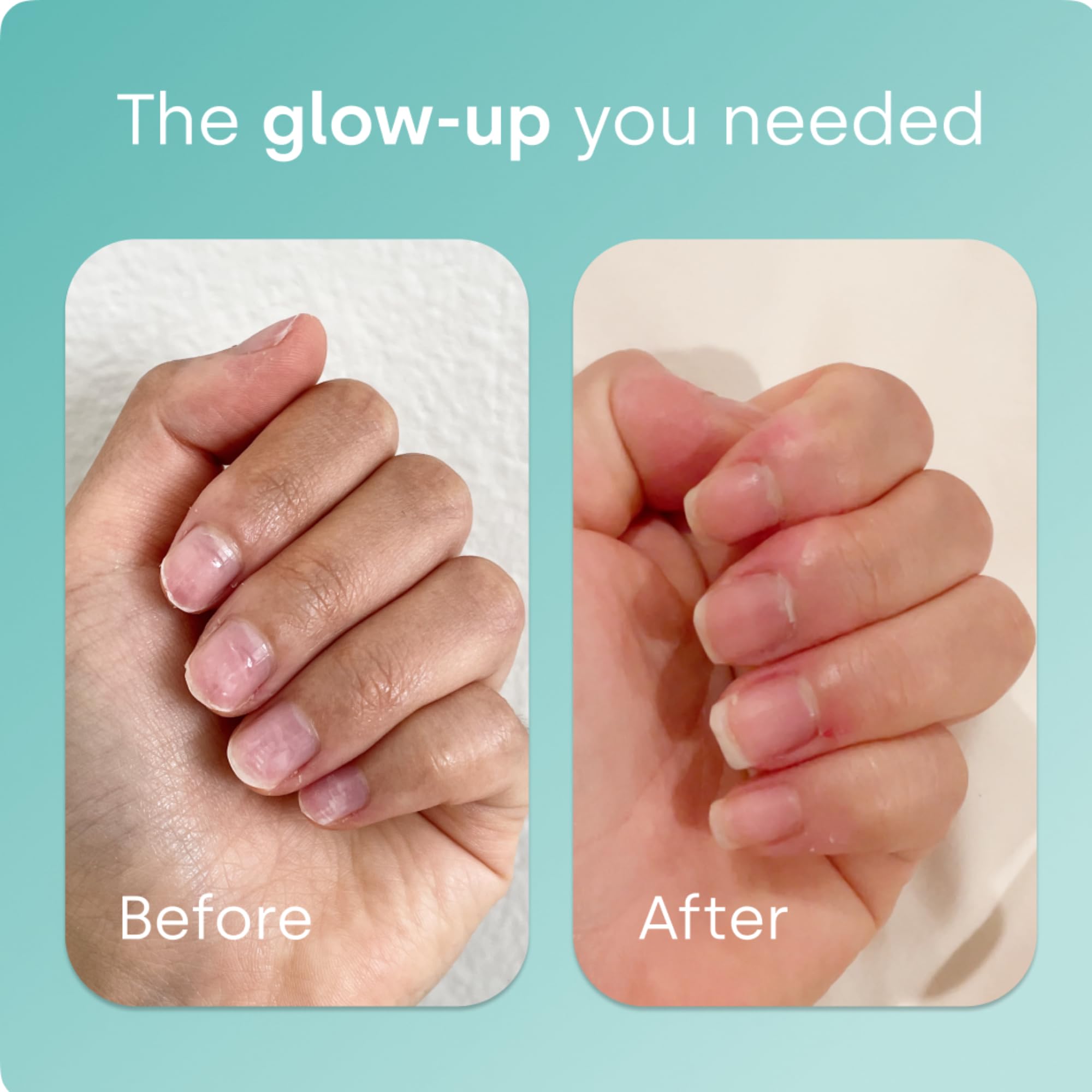 Biosil Generador de Colágeno – uñas más sanas y resistentes