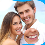 Gemas dentales Boao multicolor: brillo y estilo único para sonrisas.