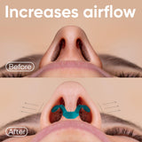 Brison dilatadores nasales antironquidos: reduce ronquidos de forma natural para noches más tranquilas.