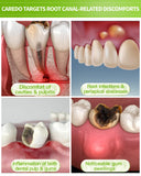 CAREDO pasta dental aplicación dental para reparación ligera de dientes