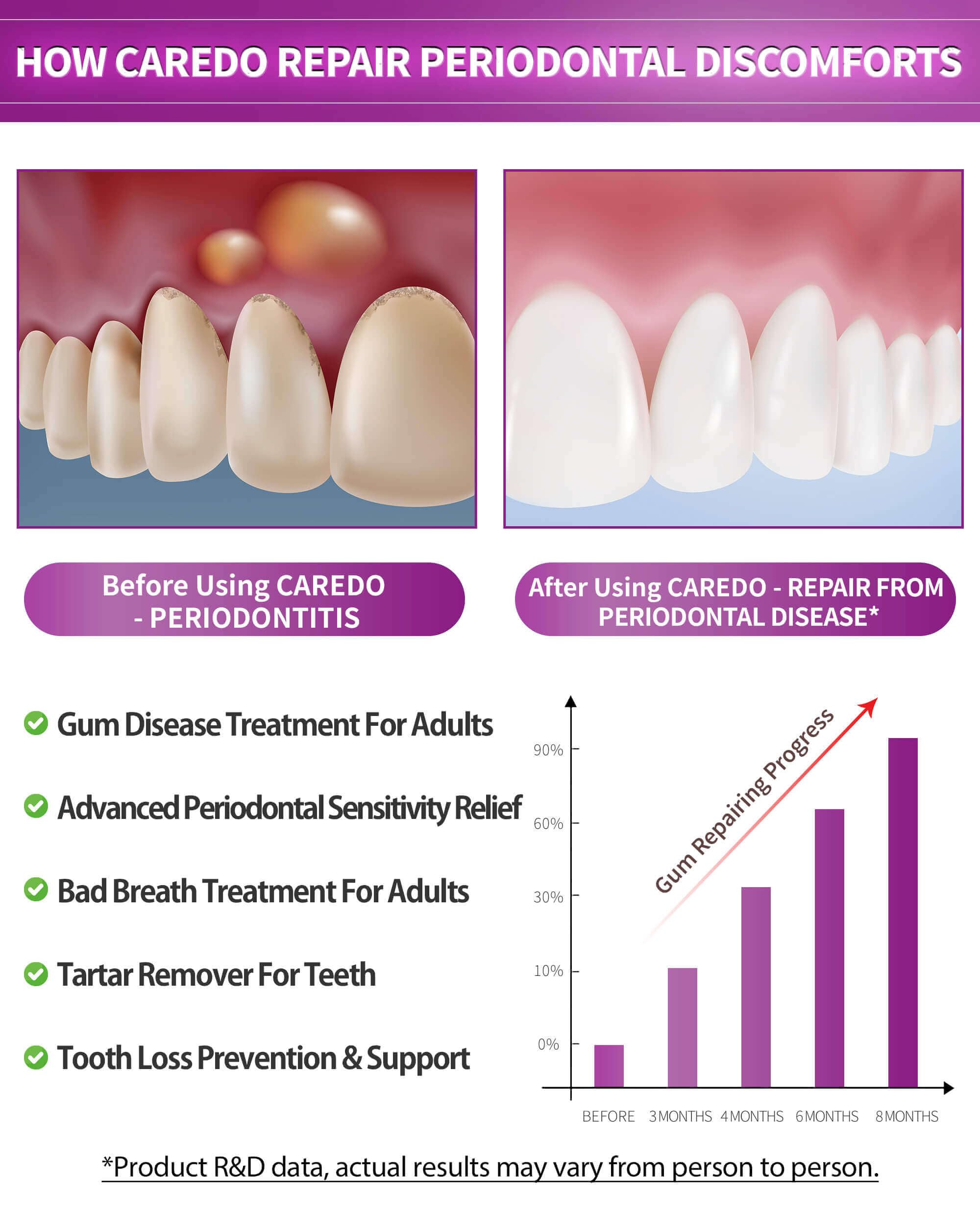 Caredo pasta dental de sensibilidad periodontal alivia molestias y cuida encías