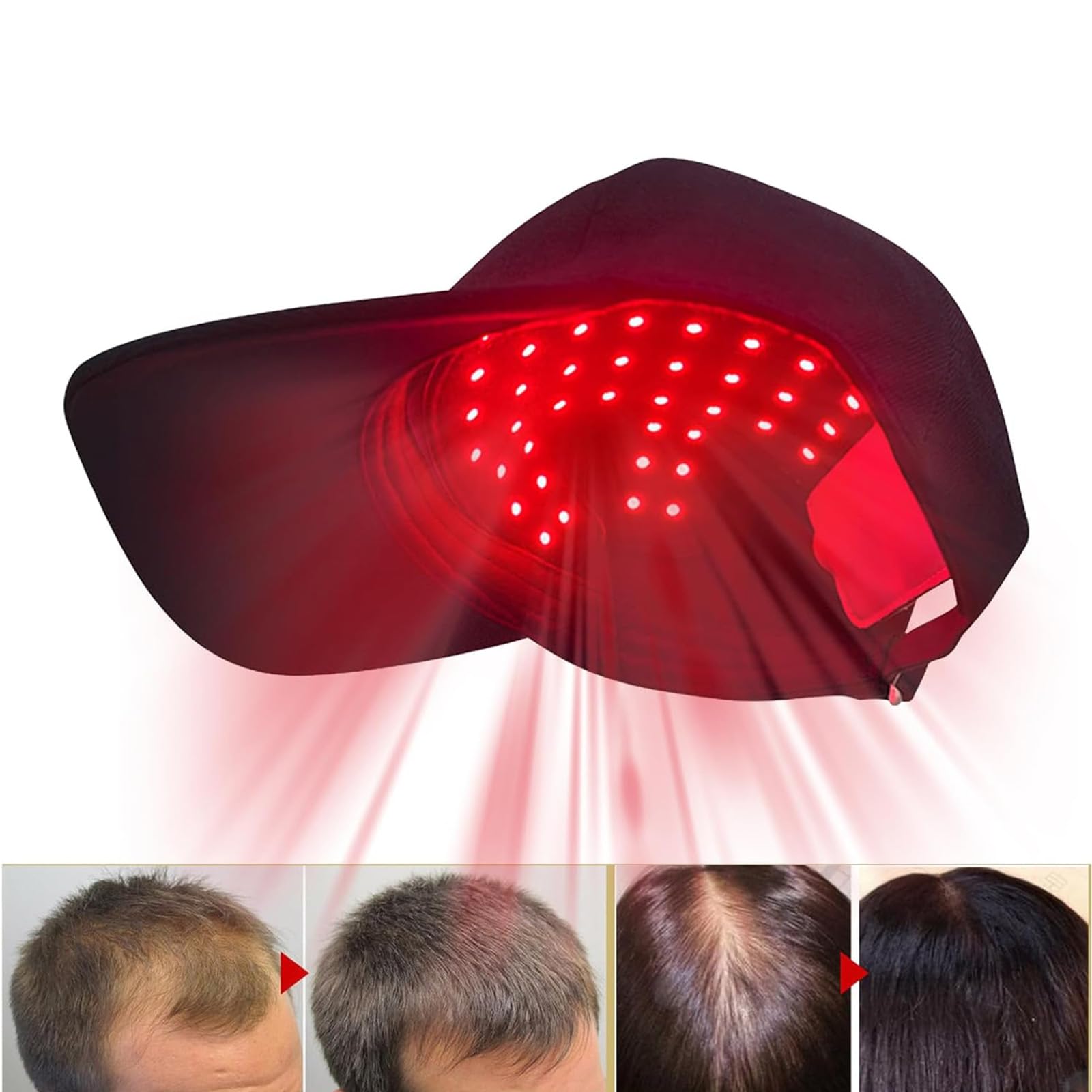 Módulo de luz led multiespectral cilate, combina rojo y azul para cuidado capilar.