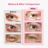 CONBELLA parches gel para ojos, tamaño pequeño, uso dirigido para inflamación.