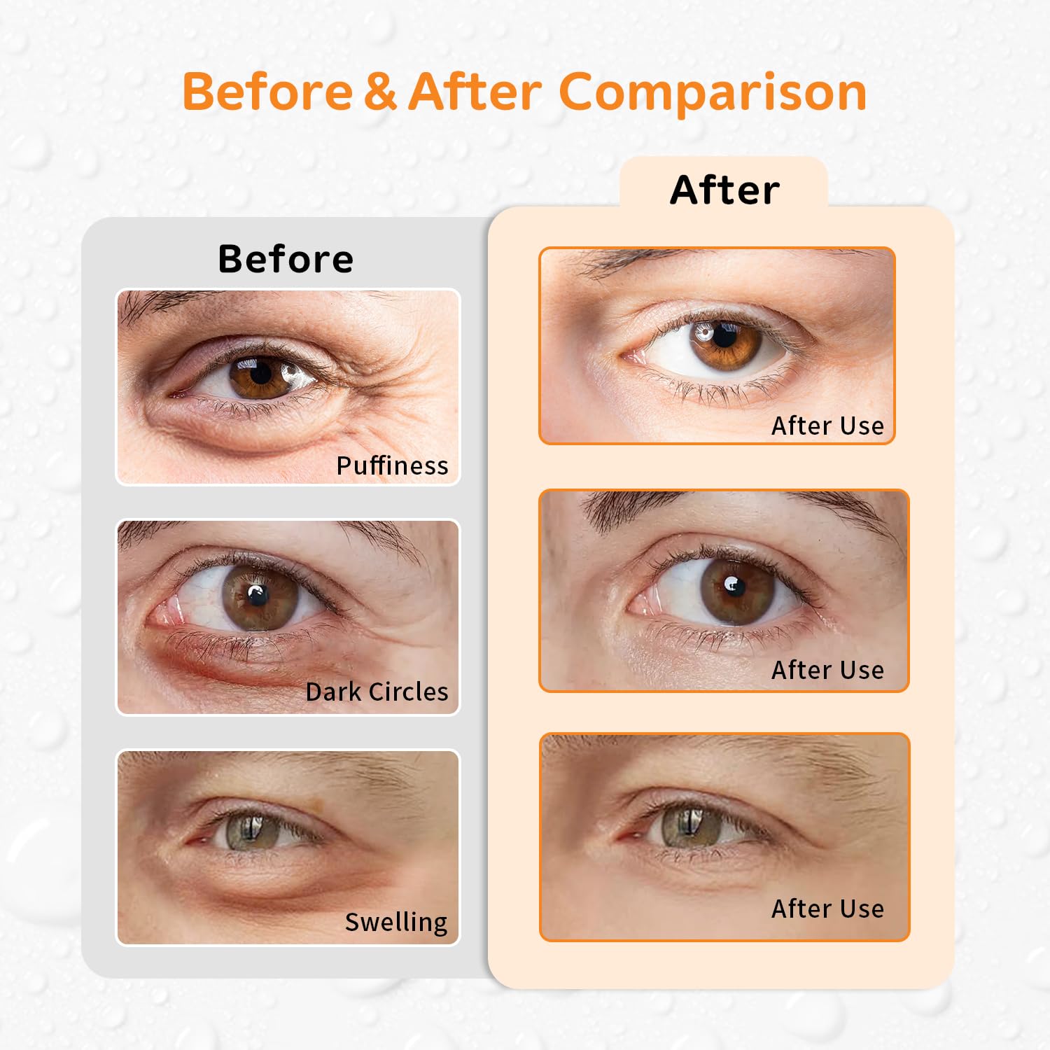 Set de CONBELLA de 4 piezas para ojos con flores naranjas, SPA en casa.