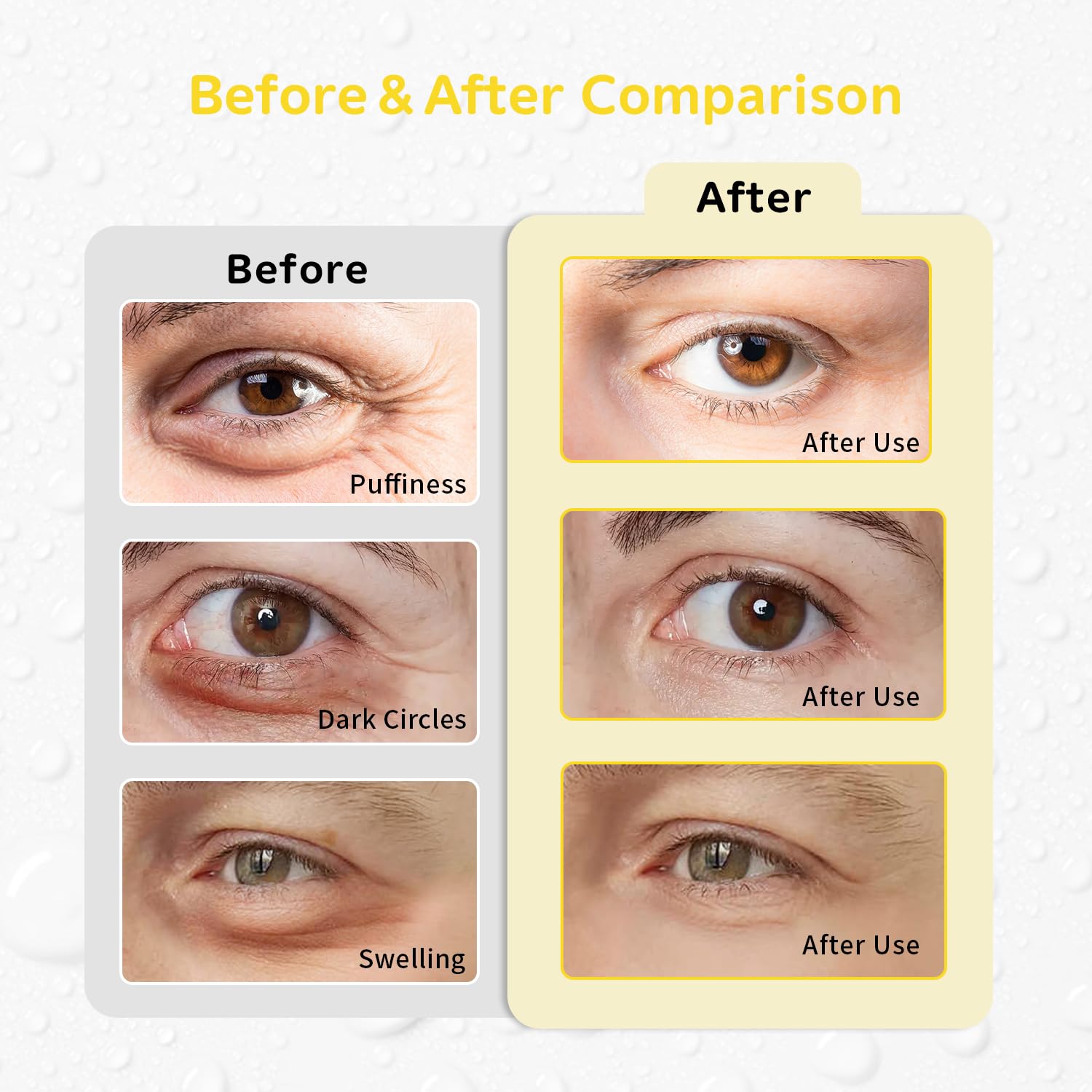 ConBella almohadillas gel ojo frío, refrescante para ojos cansados tras un largo día.