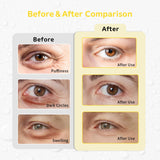 ConBella almohadillas gel ojo frío, refrescante para ojos cansados tras un largo día.