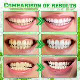 cuoct sonrisa con dientes blancos tras el enjuague