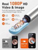 DEETOK otoscopio con luz para oídos ofrece visión clara del cerumen.