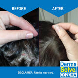 Dermasolve avena coloidal protegiendo el cuero cabelludo.