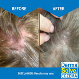 Dermasolve sin esteroides ni fragancia, opción suave.