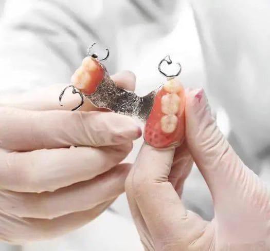 Dientes falsos: kit de reparación rápida para dentaduras parciales o completas.