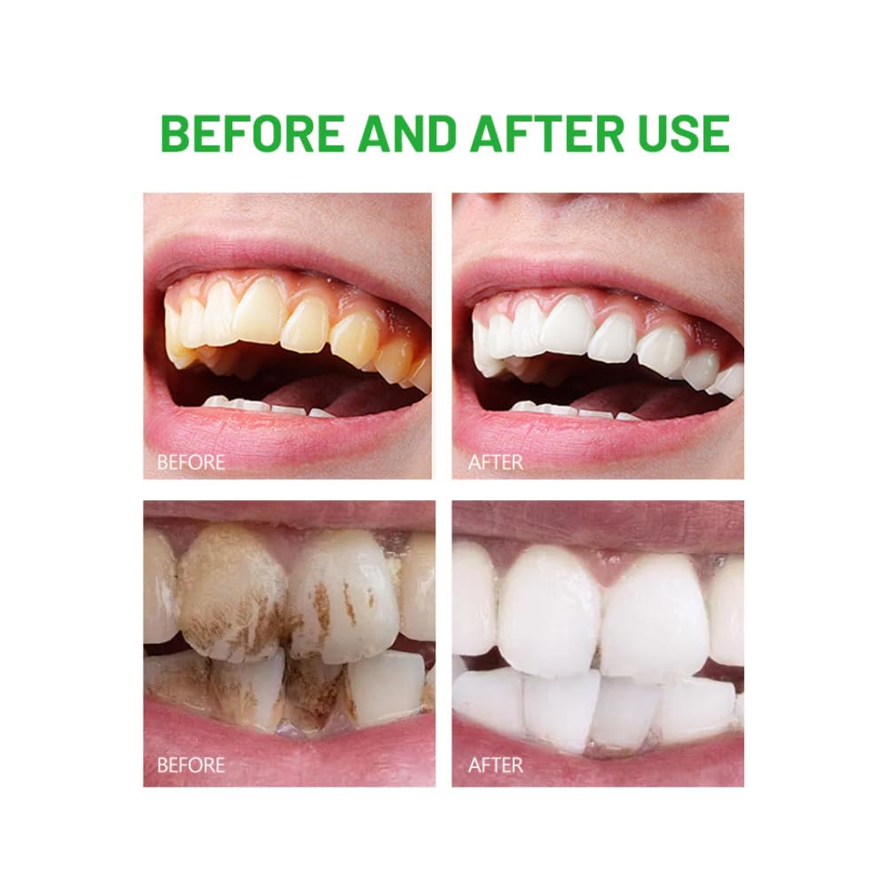 DISAAR Beauty cepillo dental con pasta, experiencia de cepillado suave.