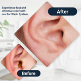 Doctor Easy Wax-Rx: paquete de tres usos para limpieza en casa