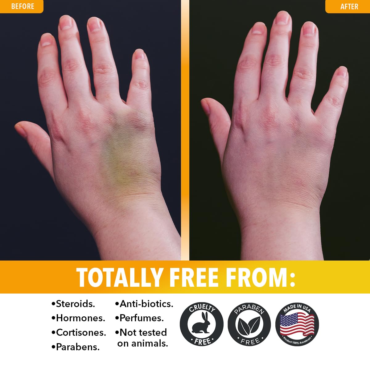 Dr. Robaina Arnica Gel con MSM y magnesio para confort en áreas delicadas.