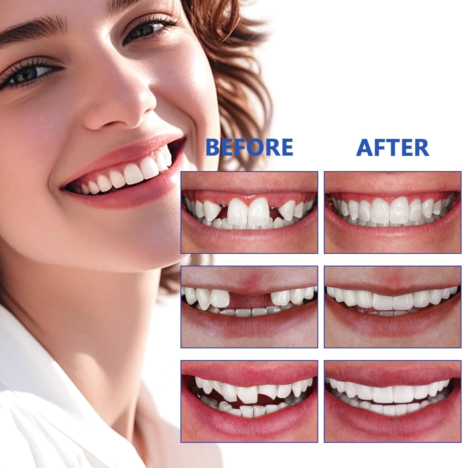 DWFKHT reparacion emergencias dentales: solución temporal para ausencias.