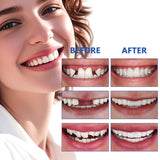 DWFKHT reparacion emergencias dentales: solución temporal para ausencias.