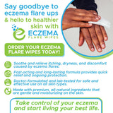 Eczema Flare Wipes: toallita humedecida para uso suave en la piel afectada.