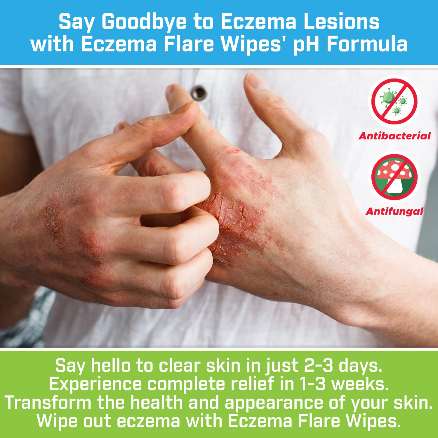 Eczema Flare Wipes: ideal para uso en casa durante periodos de irritación.