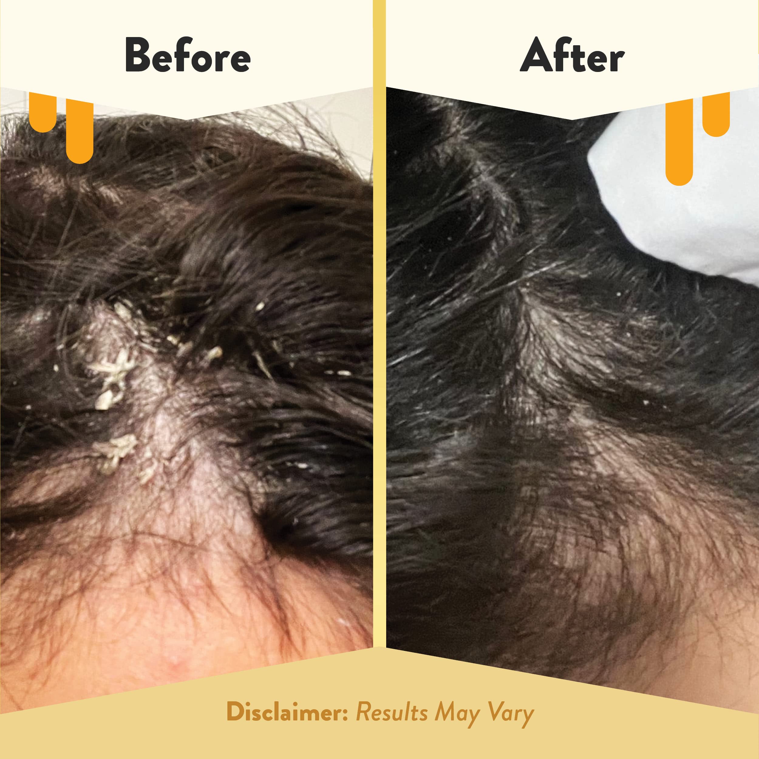 ECZEMA HONEY aloe-vera calma la irritación y reaviva el cabello