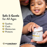 Aplicación de ECZEMA HONEY en la mano para cuidado diario de la piel.