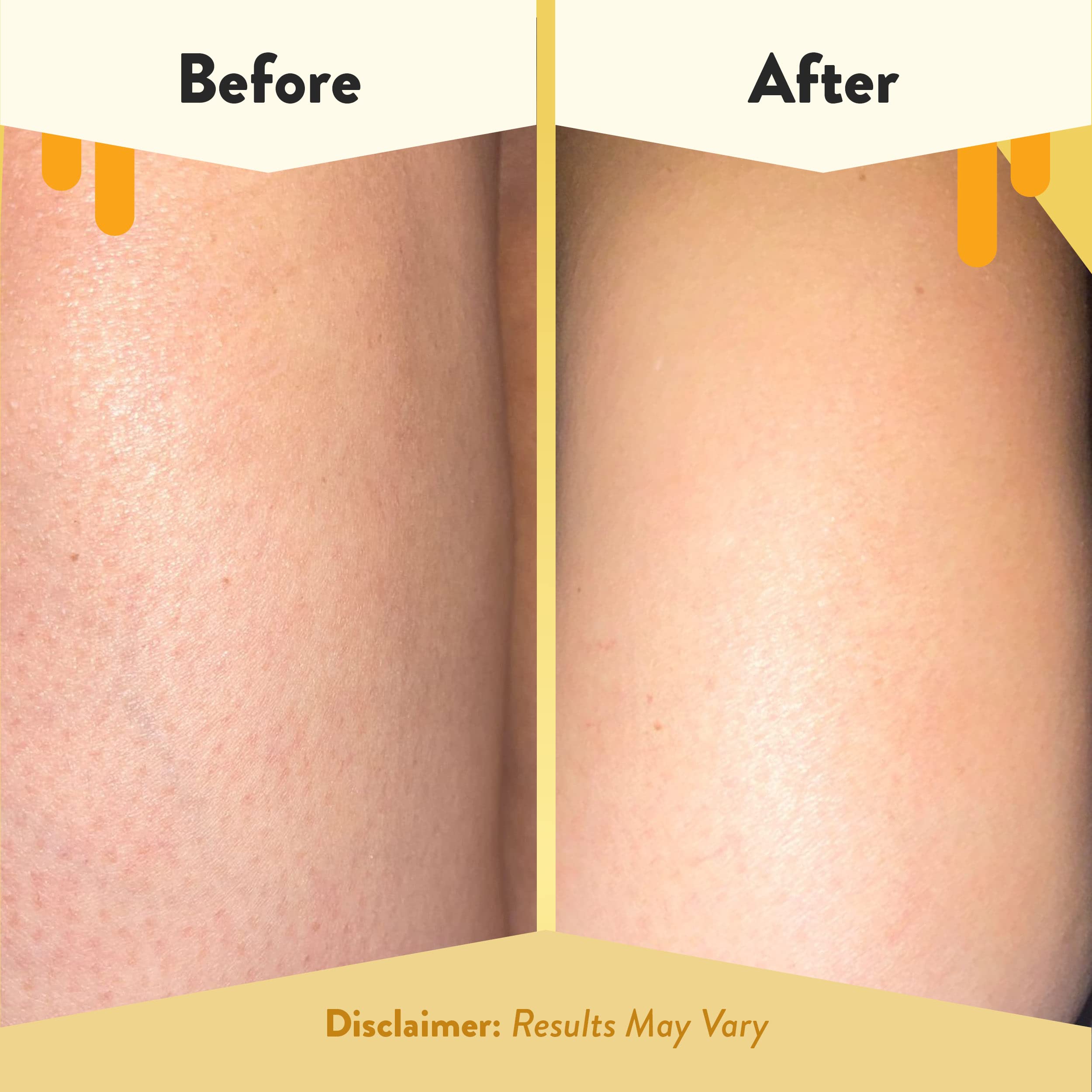 Eczema Honey, aplicación suave en piel sensible con hidratación ligera.