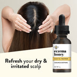 ECZEMA HONEY avena-coloidal exfolia suavemente y alivia la picazón