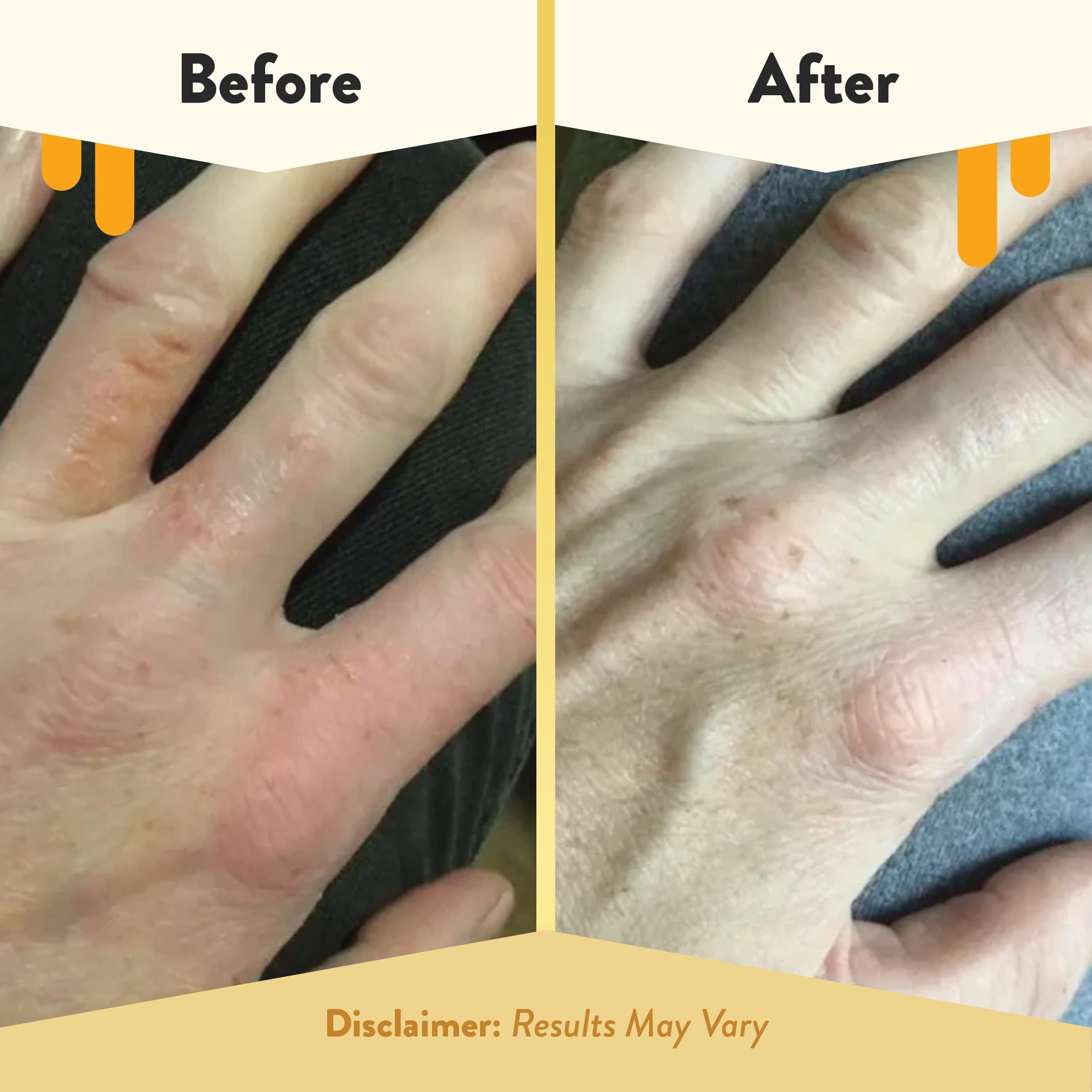 ECZEMA HONEY crema sin parabenos, sulfatos ni fragancias para piel sensible