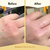 ECZEMA HONEY crema hidratante para cuerpo con piel seca