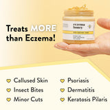 ECZEMA HONEY textura cremosa lista para uso diario